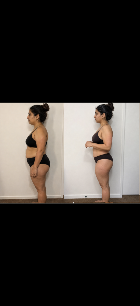 Anika transformation